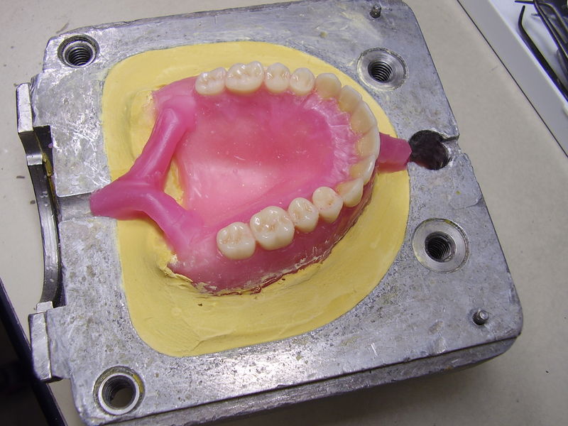 A set of dentures with pink gums and white teeth is shown during the molding process, dentures, teeth, pink gums, gums, pink, white teeth, teeth, production, mold, dental, dentist, dental insurance, insurance, dental coverage, coverage, insurance, insurance coverage, medical, medical coverage, medical insurance