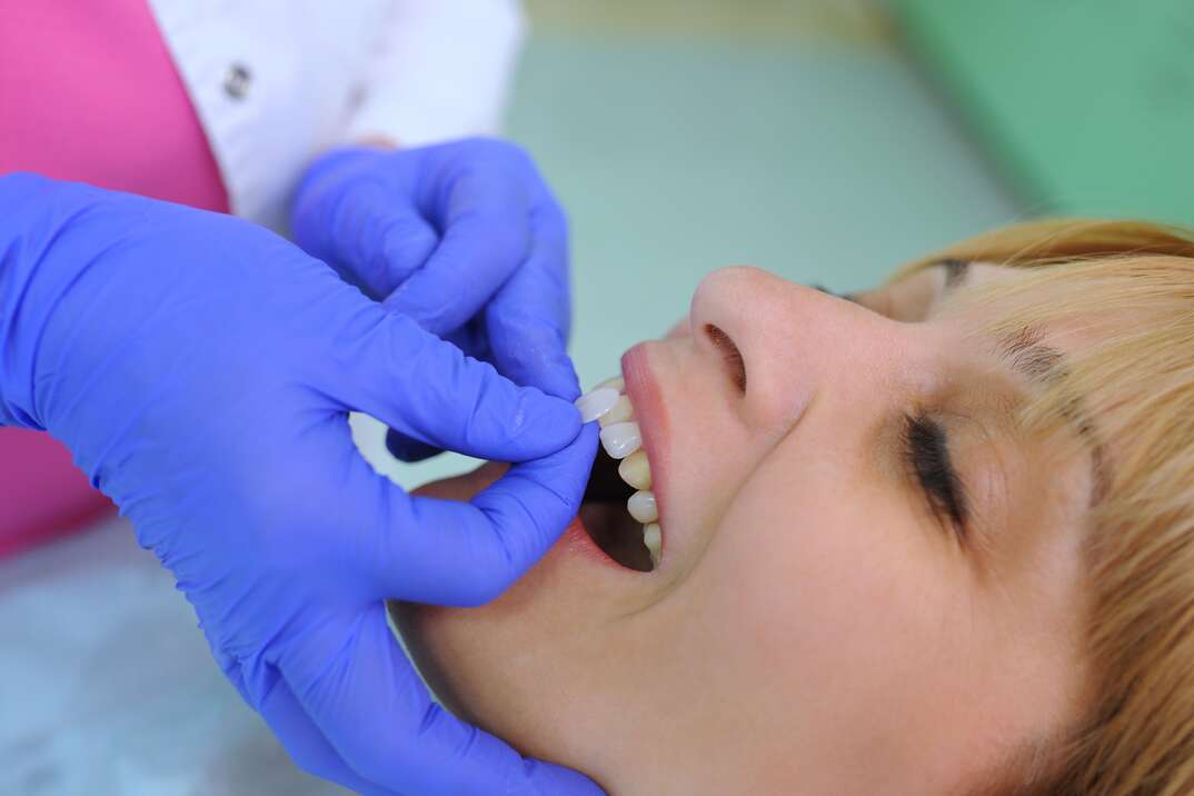A dentist wearing blue rubber gloves uses a medical instrument to attach a dental veneer to the tooth of a female patient reclined in the dentist chair with her mouth open, blue gloves, blue rubber gloves, rubber gloves, gloves, dentist, dental, oral, doctor, medical, teeth, tooth, dental veneers, veneers, female patient, patient, female, open mouth, dental implants, implants